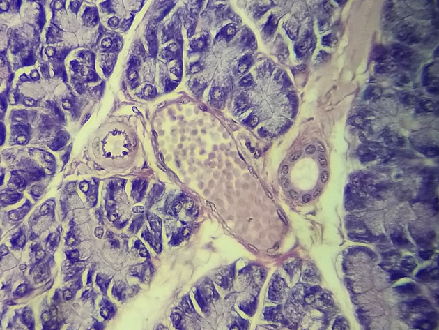 Pancriatic Artery Vein and Duct Slides